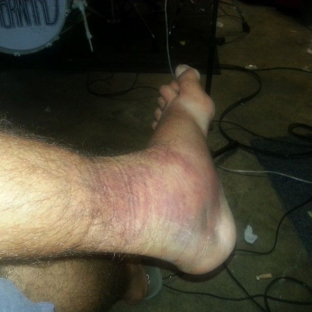 Rosedale - Crazy Tour Stories Image 2